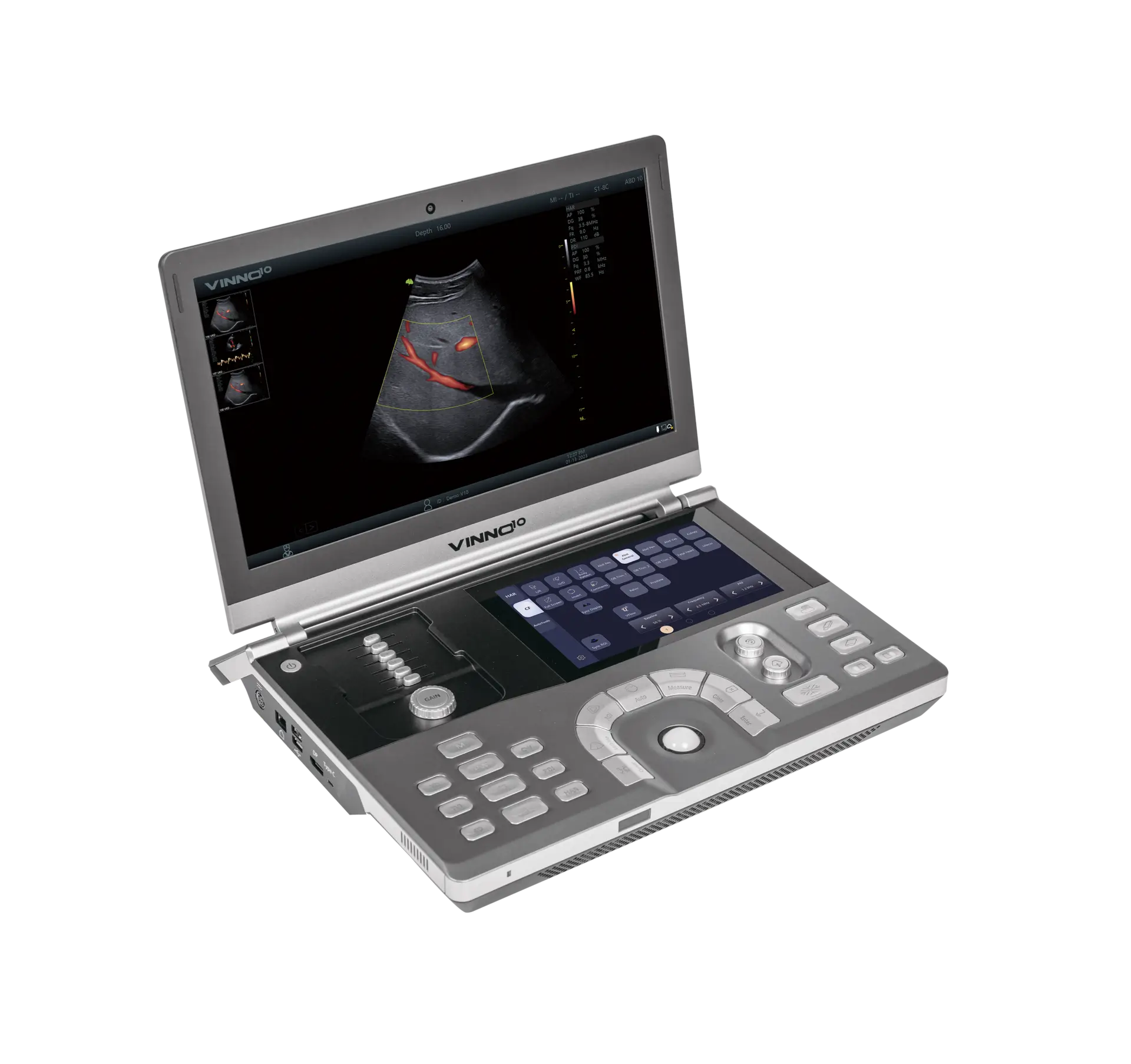 ecografo-portatil-vinno-D10.webp