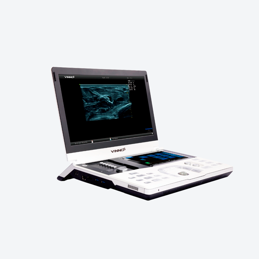 Ecógrafo portátil Vinno D5