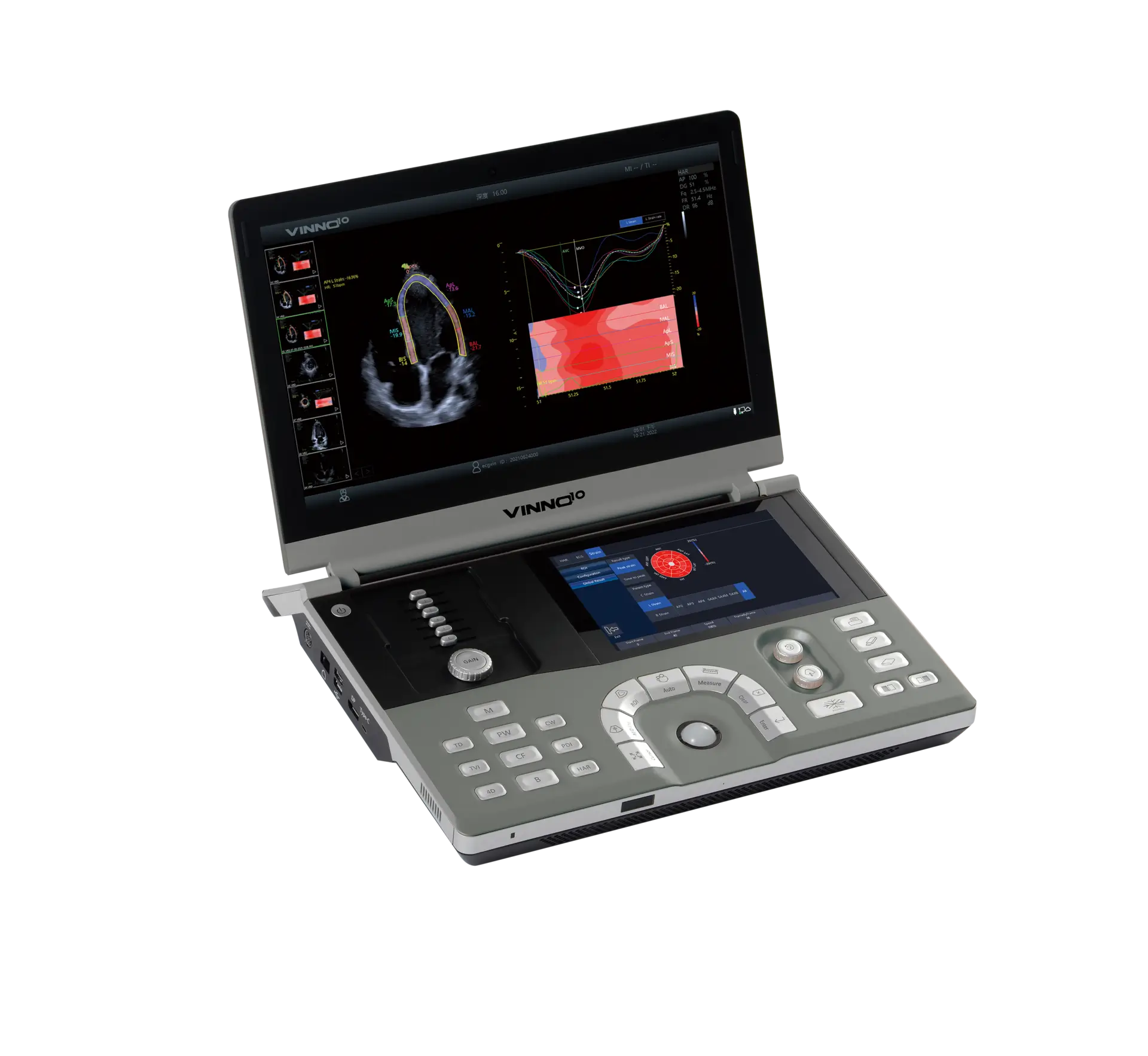 Ecógrafo veterinario portátil Vinno D10